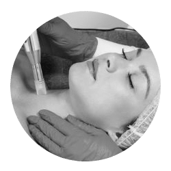 Microneedling services